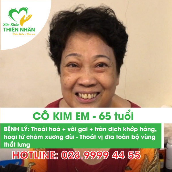 Cô Kim Em - Thoái hoá, vôi gai, tràn dịch khớp háng, thoái vị đĩa đệm