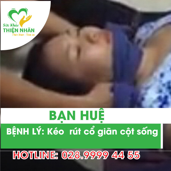 Chia sẻ bệnh nhân cổ giãn cột sống sau điều trị bằng tác động cột sống