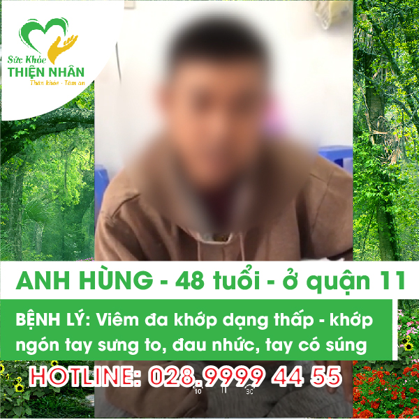 Anh Hùng - Viêm đa khớp dạng thấp – khớp ngón tay sưng to , đau nhức