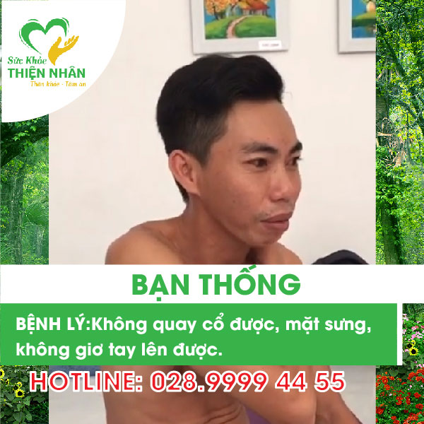 Chia sẻ bệnh nhân không quay cổ được, mặt sưng khi điều trị bằng tác động cột sống - anh Nhất