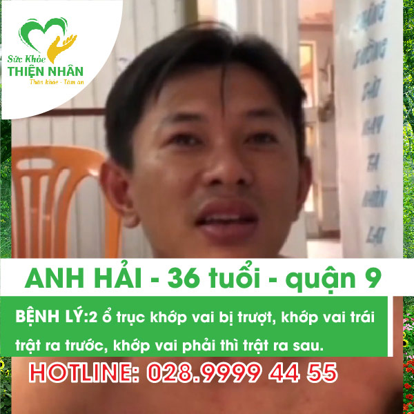 Khớp vai bị trượt, khớp vai trái trật ra trước, khớp vai phải thì trật ra sau - anh Hải