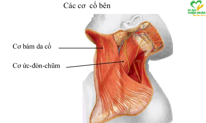 Bệnh đau sau gáy cổ 