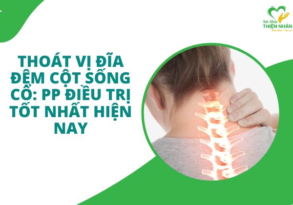 Thoát Vị Đĩa Đệm Cột Sống Cổ: PP Điều Trị Tốt Nhất Hiện Nay