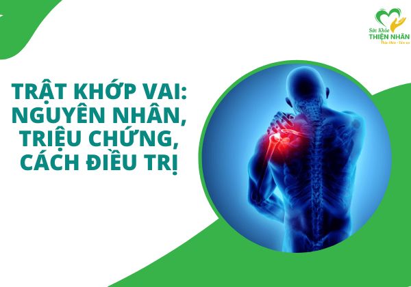 Trật khớp vai: Nguyên nhân, triệu chứng, cách điều trị